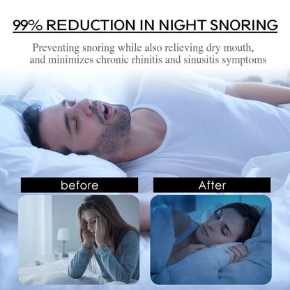 Elevate+ Mouth Tape _ Breathing _ SolisSleep _ Breathing, snoring